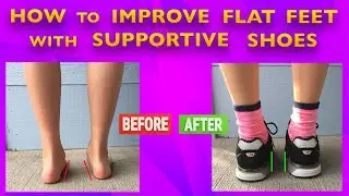 How to Improve Flat Feet in Kids with Supportive Shoes - With 3 Real Life Examples