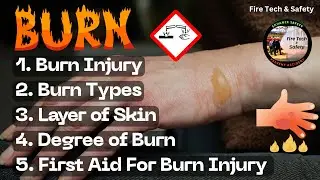 Burn क्या है ? Burn Types & Causes / Skin Layer / Degree of burn / Burn First aid #burninjury #burn