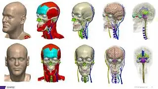 Simpleware-CCNY Head Model: Advanced Tool for Design & Simulation