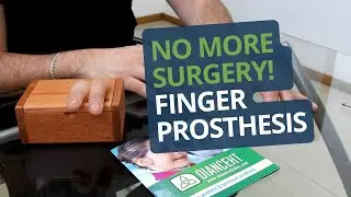 No More Surgery! Experience Hyper-Realistic Finger Prosthetics ✨