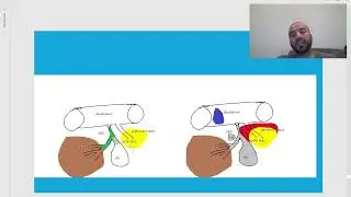 Small Animal Liver 5/5: Ultrasound fine and core biopsies   أخذ عينة خلية و-نسيج  الكبد بالسونار