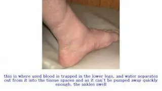 what is a legs health care plan?