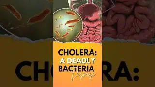 Cholera: A deadly bacteria Disease. #cholera #choleraprevention #CholeraAwareness