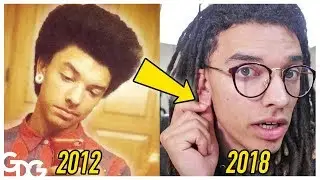 Why I Closed My Stretched Ears