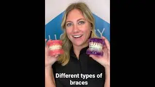 5 types of Braces: Metal, self-ligating, porcelain, sapphire braces and clear Aligners.