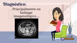 Oncocitoma renal parte 2