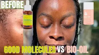 HOW TO FADE DARK SPOTS FOR UNDER $20 | Good Molecules vs Bio Oil