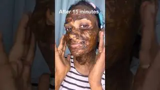 Remove sun tan easily #pure natural #beautytips #malayalam #suntanremoval