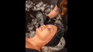Morpheus 8 Burst Radio Frequency Treatment