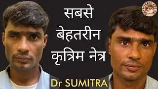 The ABSOLUTE BEST Artificial Eye Technology You Can Buy Now सबसे बेहतरीन कृत्रिम नेत्र