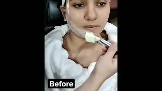 #skinpolisher#contact#instagam#manoo_r687#