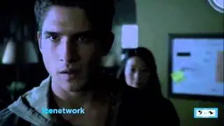 Teen Wolf 317 Silverfinger  Sneak Peek