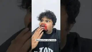 Backbenchers after result 😂🔥 #backbenchers #boardexam #examresults #ytshorts #funnyshorts