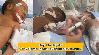 Day 1 to 42 &mdash; The Heart-Touching Journey of a NICU Baby 💞
