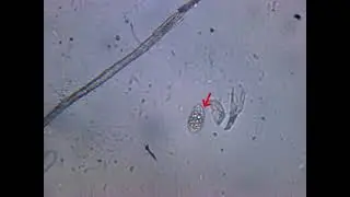 entosiphon sulcatum под микроскопом