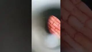 Onion peel under Microscope