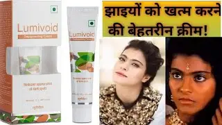 Lumivoid cream review| Lumivoid cream | Lumivoid cream review in hindi| lumivoid depigmenting cream