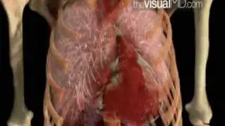 Enlarged Heart and Consquences - TheVisualMD.com
