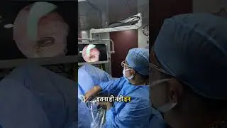 Hysteroscopy Explained!!