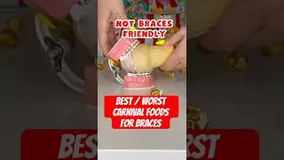 Best / WORST CARNIVAL FOODS for BRACES 🦷 #braces #carnival #crunchy