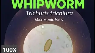 Microscopic view of Trichuris trichiura