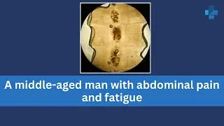 A middle-aged man with abdominal pain and fatigue