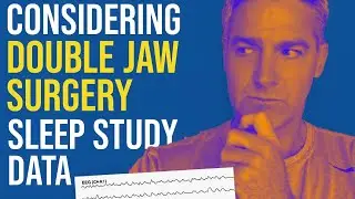 Sleep Study Raw Data Review.  Considering Double Jaw Surgery?