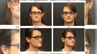 Botox In seattle | cosmeticsurgeryforyou.com