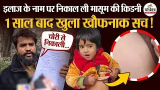 डॉक्टरों ने चुरा ली मासूम की किडनी?अब दर्ज हुआ केस। Mathura KD Hospital । Kidney Theft Case
