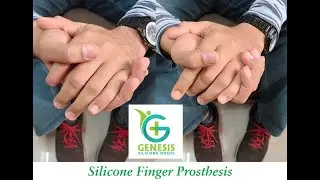 Artificial Silicone Finger in India: Realistic & Custom-Made Prosthetics