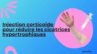 Injection cortico&iuml;de pour r&eacute;duire les cicatrices hypertrophiques// Ftm trans fran&ccedil;ais // CRAZYDEN