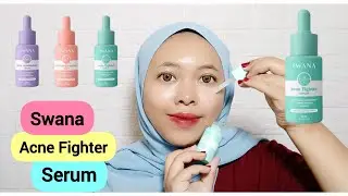 Review Swana Acne Serum - Swana Acne Fighter Serum | By Vapinka Makeup