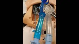HEMOPTYSIS PART FOUR DOUBLE LUMEN ENDOTRACHEAL TUBE PORTEX