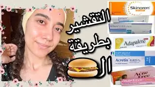 طريقة الساندوتش للتقشير الكيميائي للبشرة الحساسة | الاكرتين الديفرين الادبالين السكينورين الاكني فري