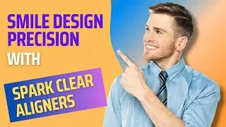Smile Design Precision with Spark Clear Aligners