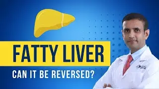 Fatty liver what is it? Can it be reversed?