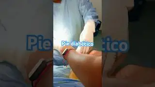 Las amputaciones de ortejos o dedos de los pies son una complicaci&oacute;n muy lamentable en diabetes 💔