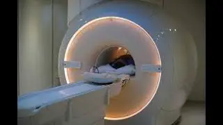 Does Migraine Cause MRI Abnormalities?