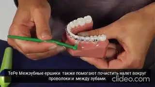 Брекеты как ухаживать ёршиком ТеРе и щеткойTePe Supreme TePe Compact Tuft  TePe Interspase