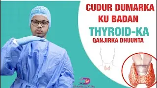 CUDURADA KU DHACA QANJIRKA DHUUNTA EE THYROID-KA. Dr faris