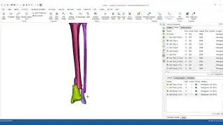 How to segment bones in MIS & prepare them for 3D printing?