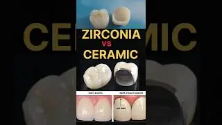 ZIRCONIA vs. PFM CROWN is equal to ELEGANCE vs TRADITIONAL CHARM! #dental #zirconia #trending #smile