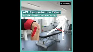 ACL Reconstruction Rehab