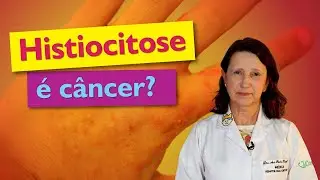 Doenças Histiocitárias: células de Langerhans, sinais e sintomas, tratamentos e mais! 🩺
