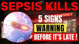 Senior: How to Spot SEPSIS Before It&rsquo;s Too Late (5 Warning Signs You Ignore Daily) | Doctor Explains