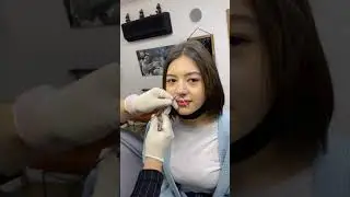 Septum delim işlemi