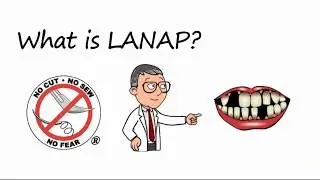 What is LANAP Laser Gum Disease Treatment in Montclair NJ Clifton NJ Bloomfield NJ 1