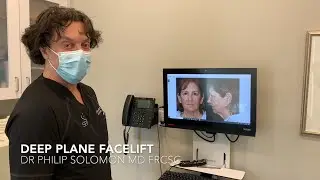 FACELIFT RECOVERY; BEFORE AND AFTER WITH DR. PHILIP SOLOMON OF TORONTO