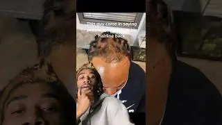BAD Hairline Transformation #shorts