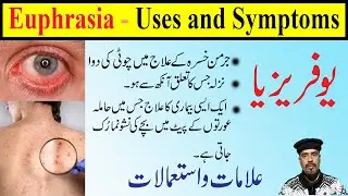 euphrasia 30, 200, 1M,1000 homeopathic medicine uses in Hindi/Urdu | euphrasia homeopathy uses